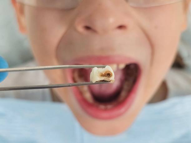 Best Broken or Chipped Tooth Repair in Gordon Heights, NY